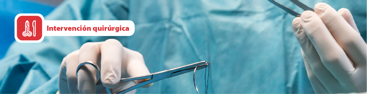 Intervencion quirurgina